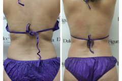 img-procedimiento-corporal-21
