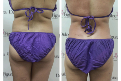 img-procedimiento-corporal-24