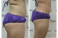 img-procedimiento-corporal-25