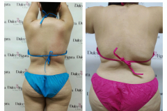 img-procedimiento-corporal-27