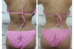 img-procedimiento-corporal-28