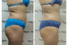 img-procedimiento-corporal-31