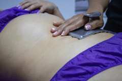 img-procedimiento-corporal-8