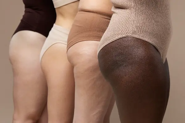 ¿Quieres saber cómo quitar las celulitis de las piernas y mejorar la apariencia de tu piel? En Dulce Figura, entendemos que este es un problema que afecta a muchas personas...