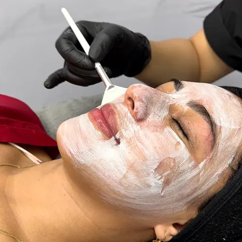 img-porcelanizacion-facial-en-medellin-1